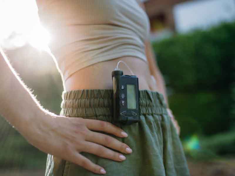 Types of Insulin Pumps