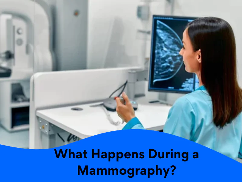 mammography