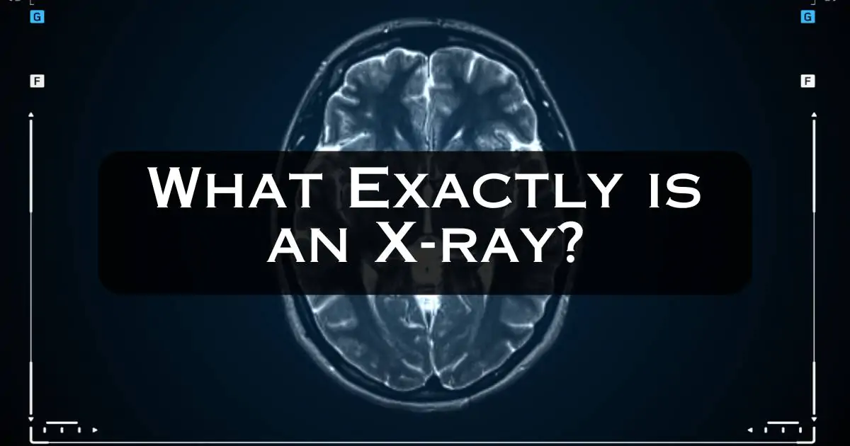 What Exactly is an X-ray